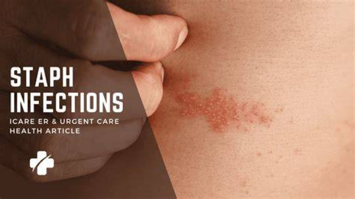 What ailment does Dr. Ed Hindson suffer from? Update on Staph Infection and Health